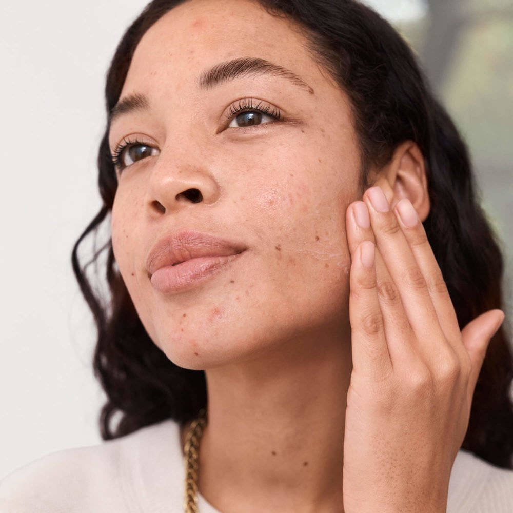 Blemish Rescue Serum - Image 2